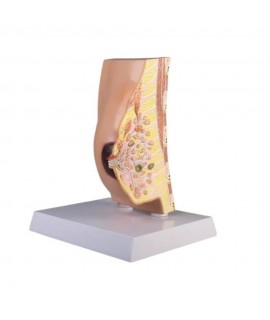 Coupe anatomique du sein avec pathologies