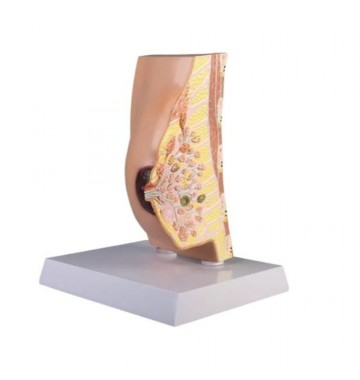 Coupe anatomique du sein avec pathologies
