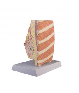 Coupe anatomique du sein avec pathologies